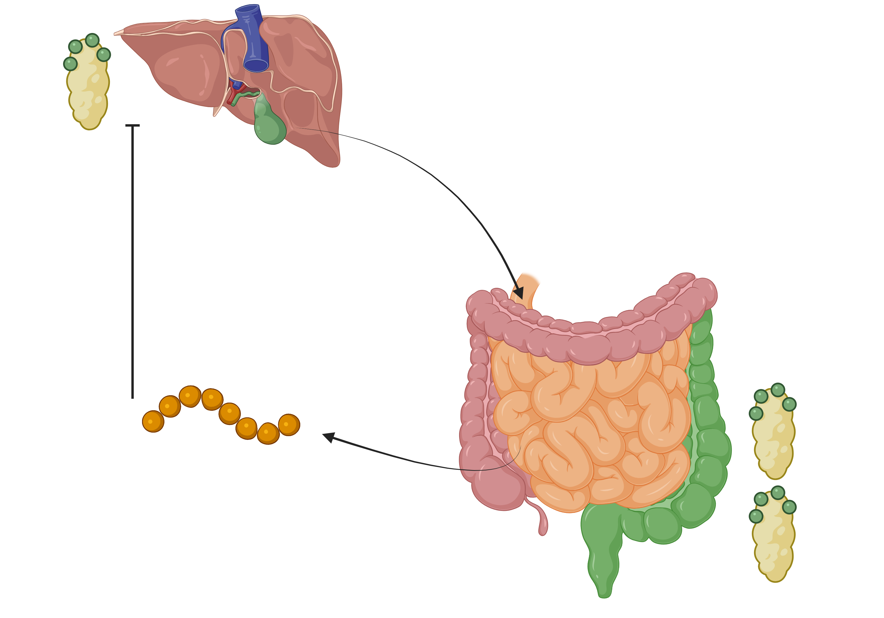 Bile Acid Diarrhoea